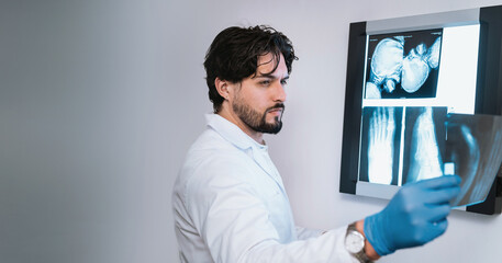 Young man doctor  examining leg X-ray on negatoscope, medical professional analyzing radiograph image of lower limb injury, orthopedic diagnosis, banner copy space