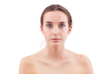 No makeup woman with real skin texture and facial imperfections, acne, pimples and blemishes. Authentic female face before skincare or beauty treatment. Looking at camera, isolated on background