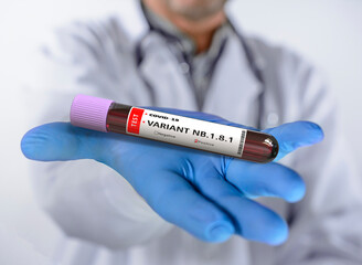Nimbus, LP.8.1 Variant. Doctor holds in hand the contagious virus Coronavirus Covid-19