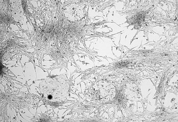 Glioblastoma cell culture.