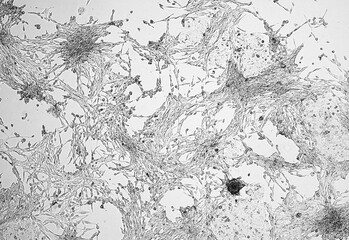 Glioblastoma cell culture.