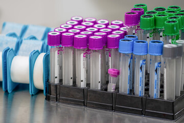 A laboratory rack holds multiple rows of clear test tubes with vibrant purple, blue, and green caps, essential for medical diagnostics and scientific research.