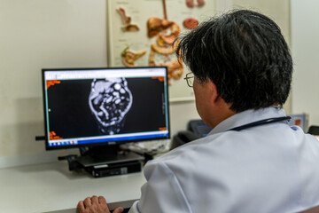 Healthcare professional viewing patient scan image on monitor. Advanced radiological tools in use...