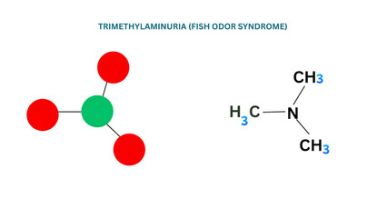 A medical illustration of trimethylaminuria fish odor syndrome disorder