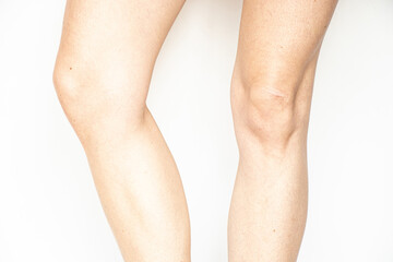 Female legs on white background, health, medical examinations theme