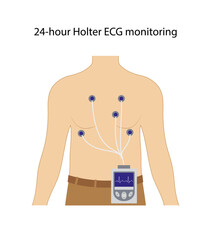24-hour Holter ECG monitoring. Electrocardiogram. Heart cardiogram. Vector illustration in flat style isolated on white background