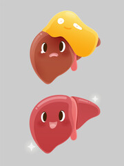 Both of these illustrations show the difference between a liver with fat buildup or fatty liver and a healthy liver.