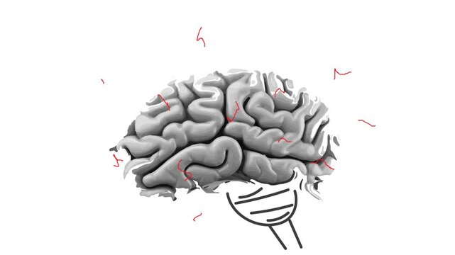 Illustration of a human brain with flashing lightning