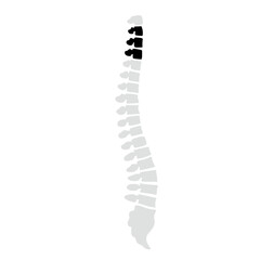 Spinal fracture vector illustration