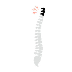 Spinal fracture vector illustration