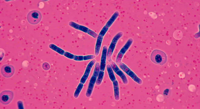 Giemsa-stained smear showing Leishmania promastigotes