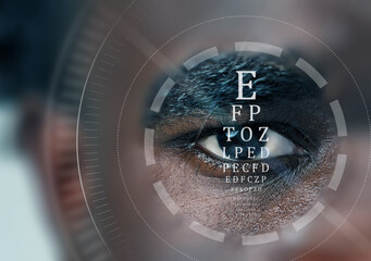 Close-up of an eye with visual acuity assessment displayed, taken at an eye clinic during daylight...