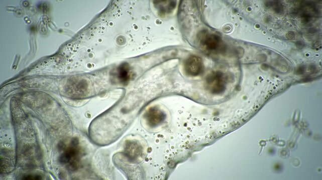 Microscopic view of an amoeba with cellular structures.