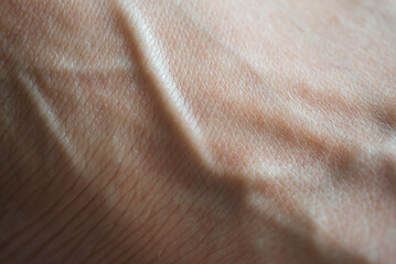 Close-up of blood vessels under a person's skin.