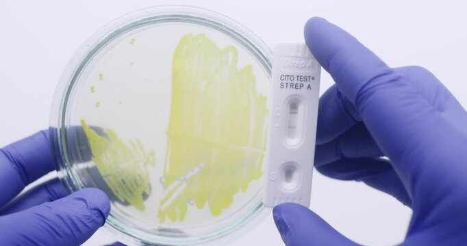 Staphylococcus bacteria in a petri dish and rapid streptococcus test from a human throat.