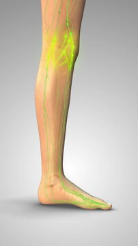 Excess Body Fluid Leading to Pitting Edema