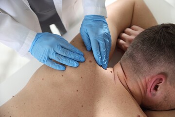 Doctor examining man's moles in hospital, closeup