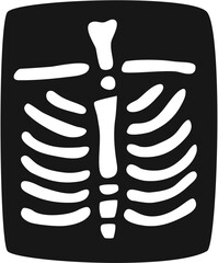 Chest X-ray with Ribcage and Spine Illustration