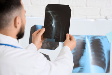 Male doctor studying x-ray scan of shoulder in clinic, closeup