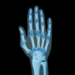 Naklejka premium Hand X Ray, Human anatomy skeleton vector illustration