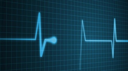 Flickering Electrocardiogram Signal Line Animation with Heart Pulse Rhythm