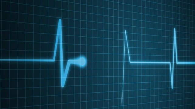 Flickering Electrocardiogram Signal Line Animation with Heart Pulse Rhythm