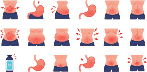 vector set of Bloating icons set. People experiencing digestive problems, discomfort, and symptoms related to stomach and gut health
