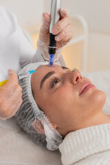 Caucasian woman girl receives forehead skin microneedling therapy with dermapen. Cosmetologist...