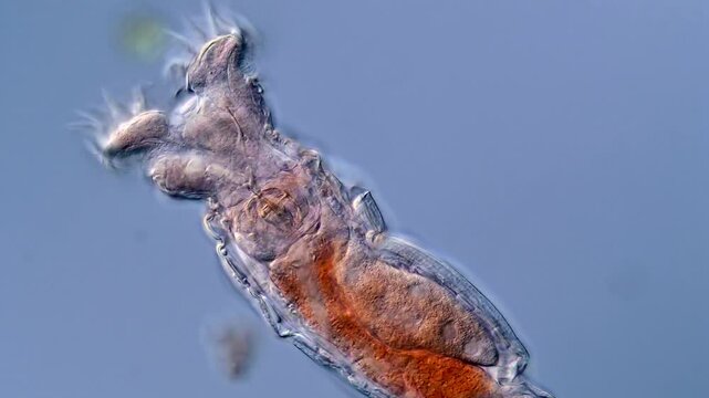 Freshwater Rotifera, water sample under DIC microscope 