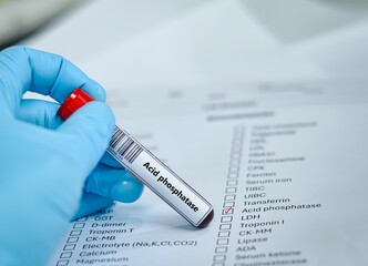 Blood sample tube for acid phosphatase test analysis