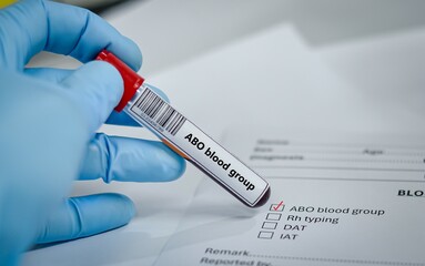 Blood sample tube for ABO blood group test analysis