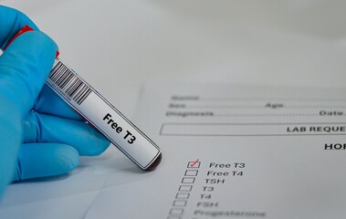 Blood sample tube for free T3 test analysis.