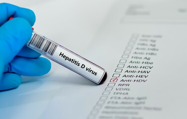 Blood sample tube for hepatitis D virus test analysis