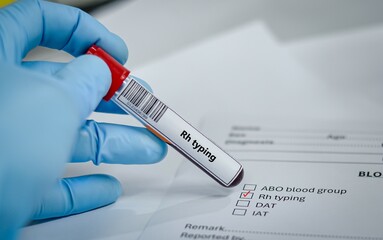 Blood sample tube for Rh typing test analysis.