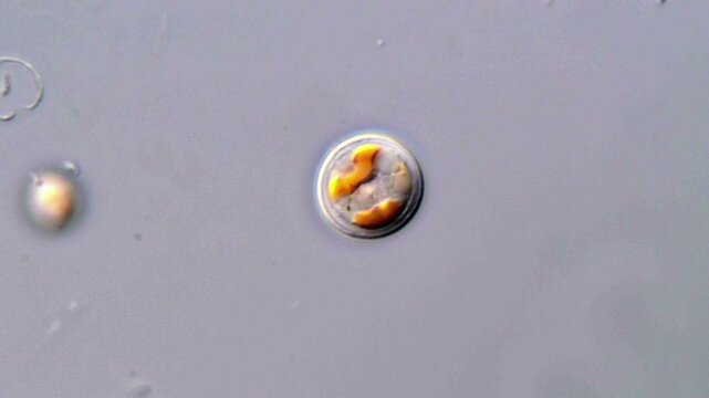 Symbiodinium algae under microscope view 1000x