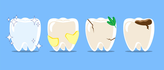 Healthy teeth, dental plaque, cracked tooth with food stuck, dental caries or tooth decayed . Set of flat design cartoon illustration . Isolated on Blue background . Vector .