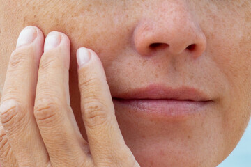 Obraz premium Woman touching her cheek with fingers showing natural skin texture and freckles