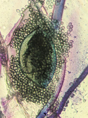 Aspergillus fungus structure under compound light microscop © Mohammed