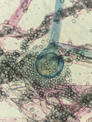 Aspergillus fungus structure under compound light microscop