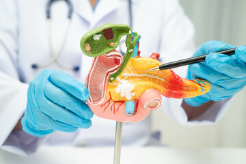 Liver with gallbladder, pancreas spleen and duodenum, Asian doctor holding human anatomy model for...