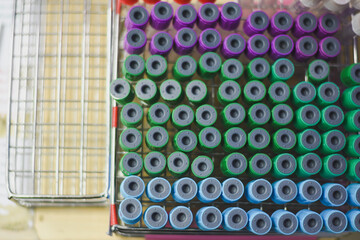 Blood collection tubes in the laboratory