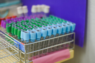 Blood collection tubes in the laboratory
