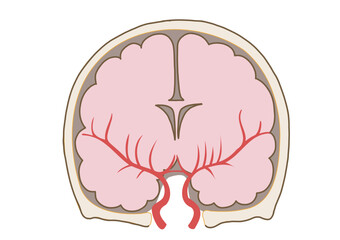 脳卒中の主な症状と脳血管の状態がわかる解剖イラスト