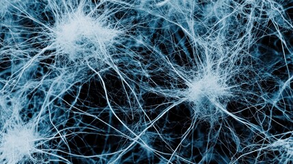 Intricate network of light-blue neural pathways against a dark background