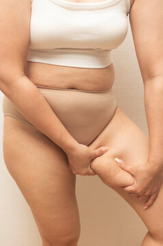 Woman standing and grabbing her inner thigh fat, highlighting natural body curves, cellulite