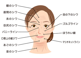 Fototapeta premium シワの種類 女性の顔 美容 シニア女性