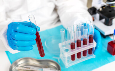 examine blood in the laboratory. Selective focus.