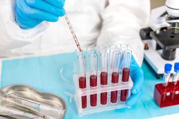 examine blood in the laboratory. Selective focus.