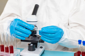 Fototapeta premium examine blood in the laboratory. Selective focus.