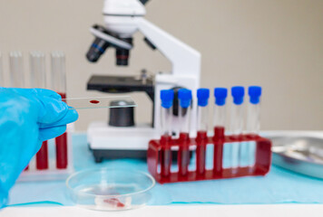 examine blood in the laboratory. Selective focus.
